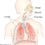 Nieuwe kijk en behandeling van COPD